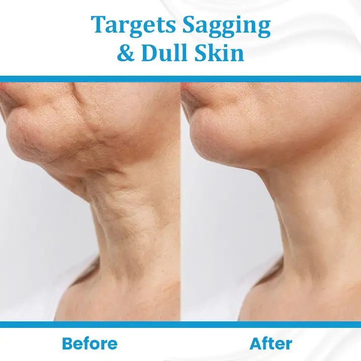 EternaLIFT Ultra Firming Skin Cream - Image 5