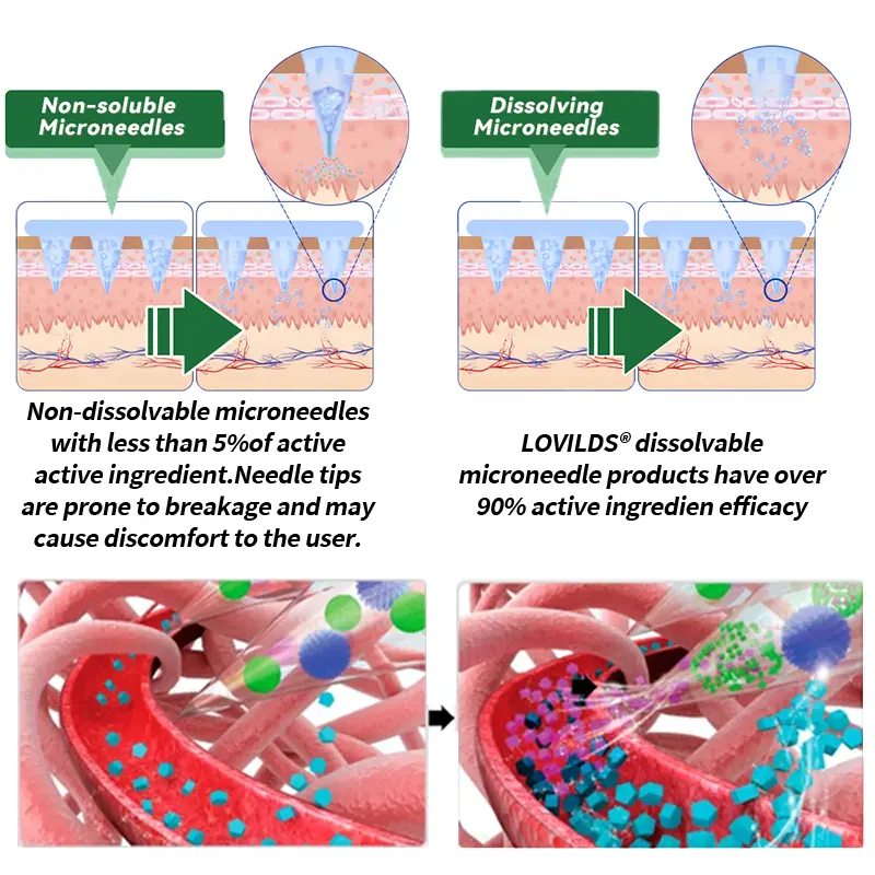 𝑴𝒐𝒓𝒊𝒏𝒈𝒂 & 𝑩𝒆𝒓𝒃𝒆𝒓𝒊𝒏𝒆 10-𝑰𝑵-1 𝑨𝒅𝒗𝒂𝒏𝒄𝒆𝒅 𝑵𝒂𝒏𝒐 𝑴𝒊𝒄𝒓𝒐𝒏𝒆𝒆𝒅𝒍𝒆 𝑷𝒂𝒕𝒄𝒉 - Image 8