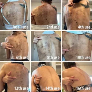 Alternative view of OceanCure Bee Venom Psoriasis & Wart Healing Cream