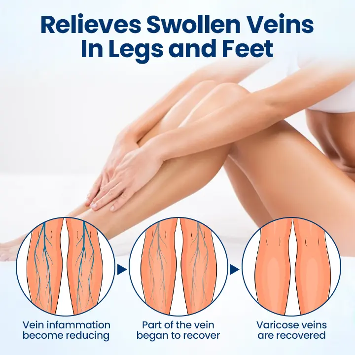 Micro-Mist Herbal Varicose Veins Spray - Image 7