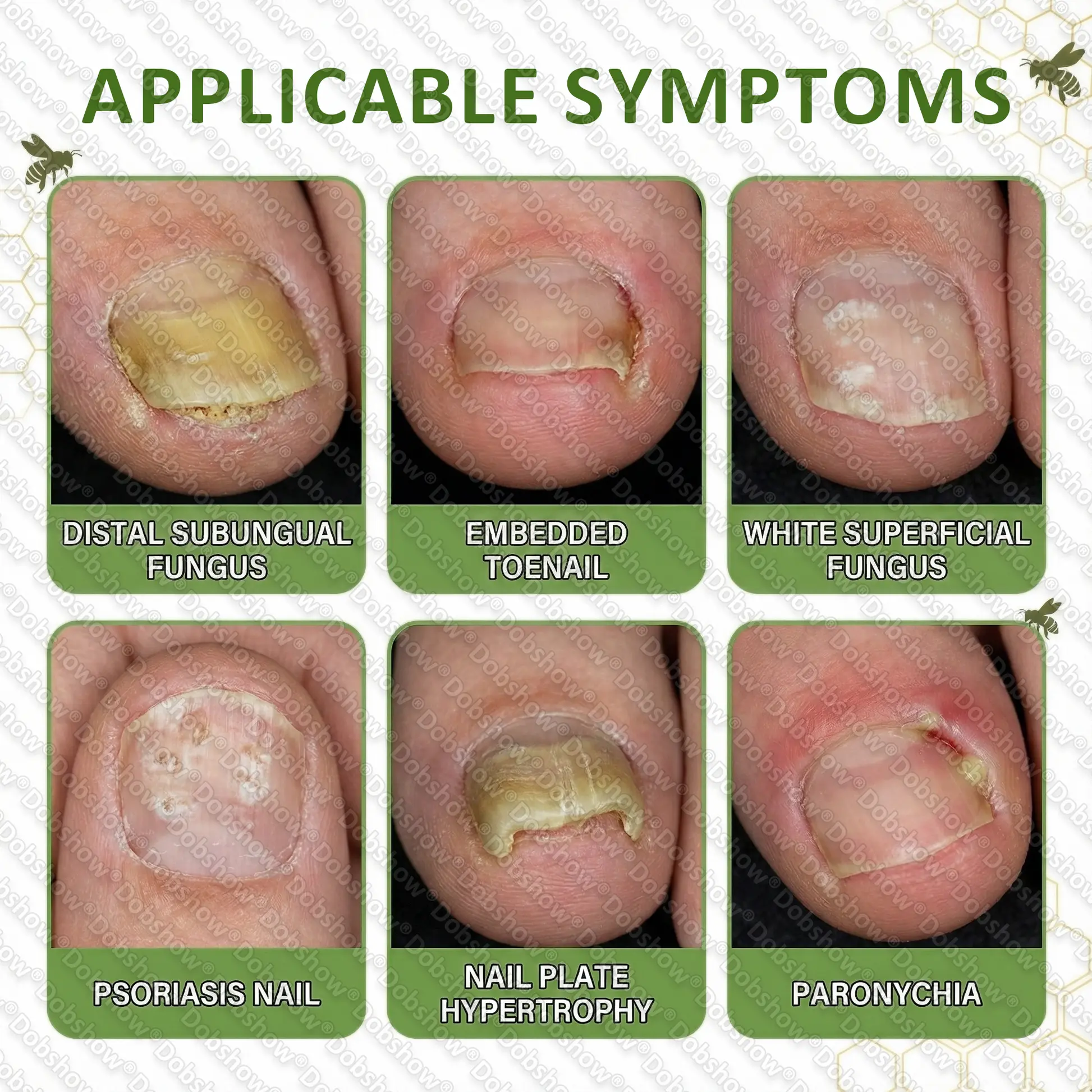 NailRescue Bee Venom Spray - Image 2