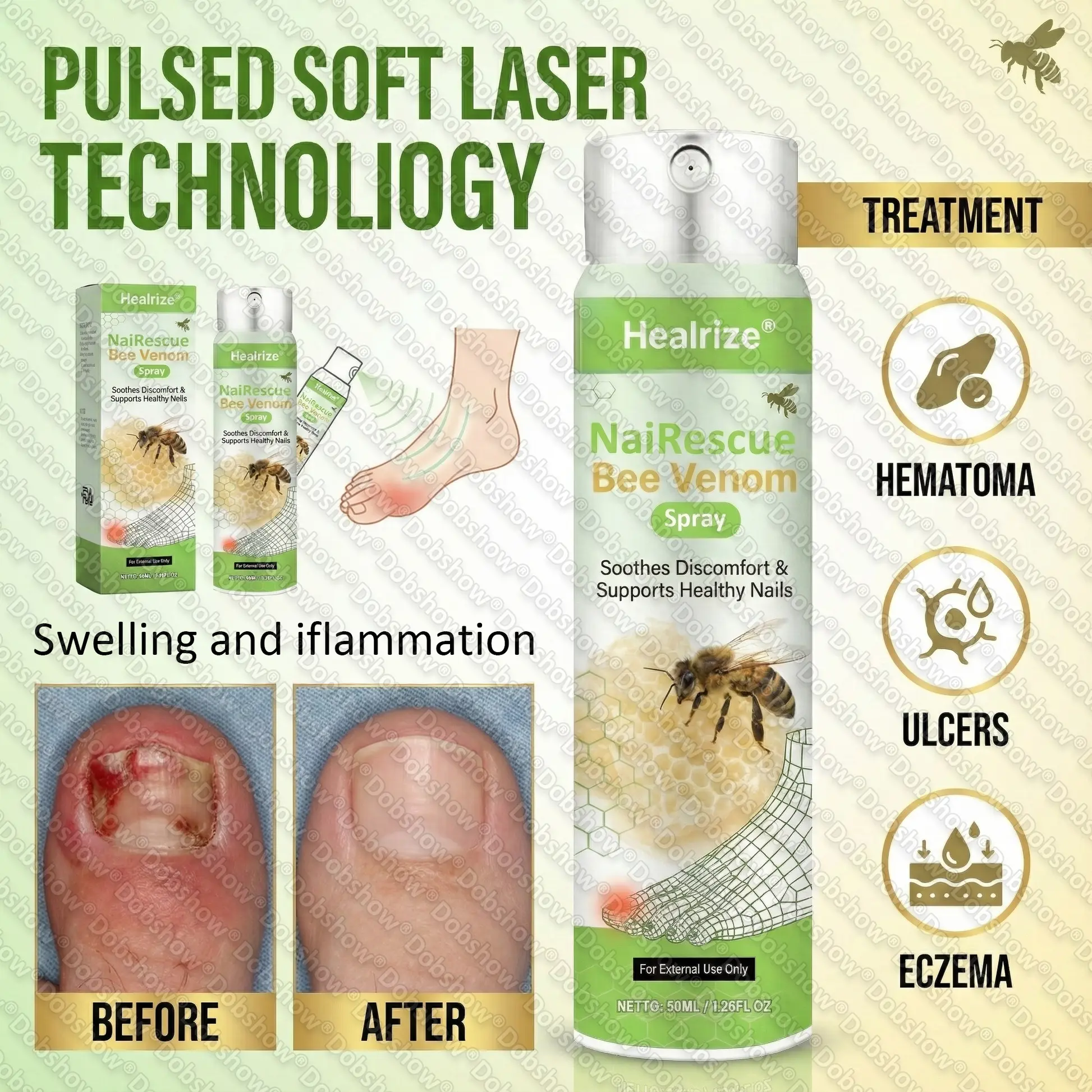 NailRescue Bee Venom Spray - Image 6