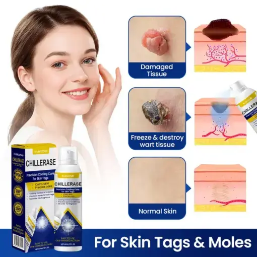 ChillErase Cooling Spray for Skin Tags - Image 7