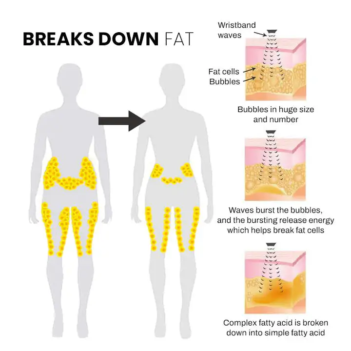 Matteo Ultrasonic Body Shape Wristband Pro - Image 10