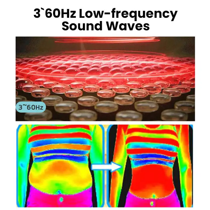 Matteo Ultrasonic Body Shape Wristband Pro - Image 8