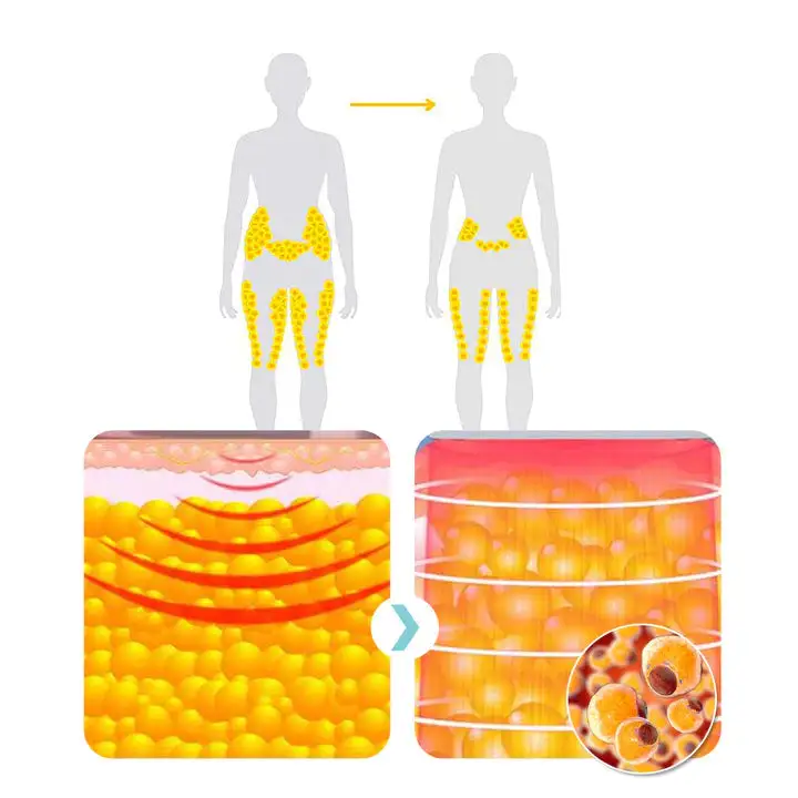 Matteo Ultrasonic Body Shape Wristband Pro - Image 9