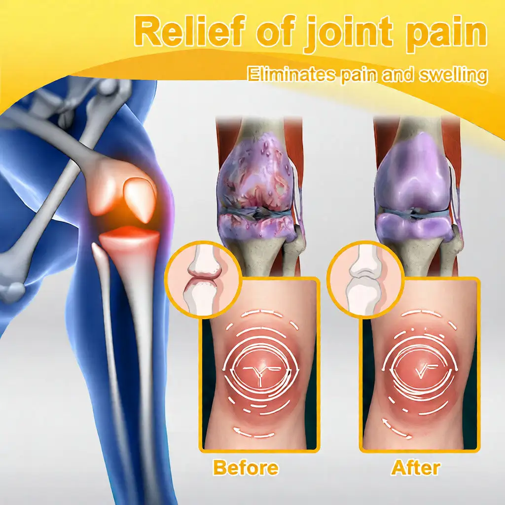 Bee Venom Pain-Relief Bone Healing Cream - Image 11