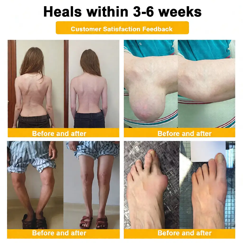 Bee Venom Pain-Relief Bone Healing Cream - Image 6