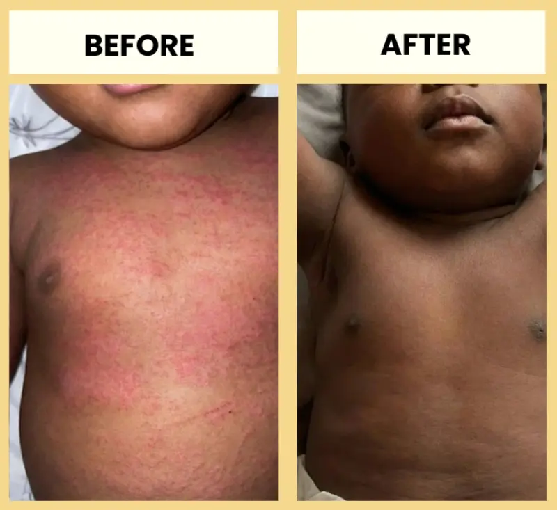 Honey Eczema Cream - Image 9