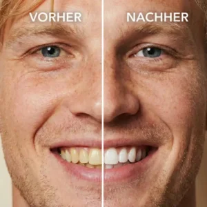 Alternative view of Tooth Polish-Brighten your smile naturally