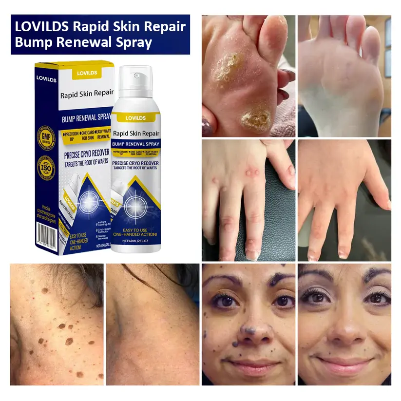 Rapid Skin Repair & Bump Removal Spray - Image 2