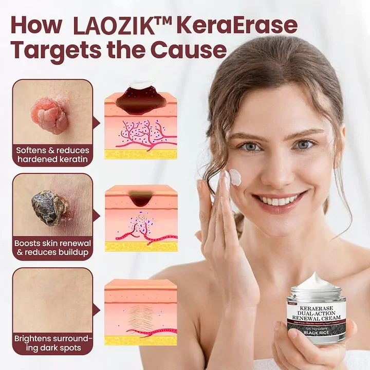 KeraErase Dual-Action Renewal Cream - Image 5
