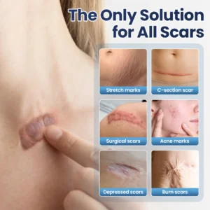 Alternative view of DERMALUX Texture Repair Gel