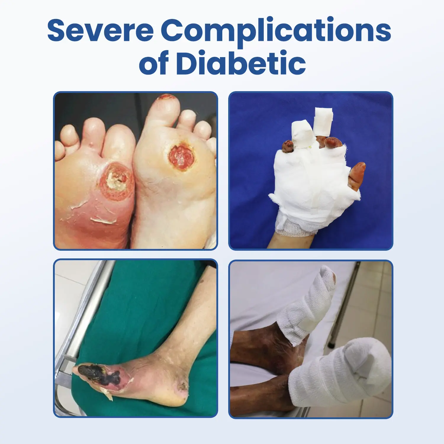 DIABEDERM BIO-DEFENSE SPRAY - Image 2