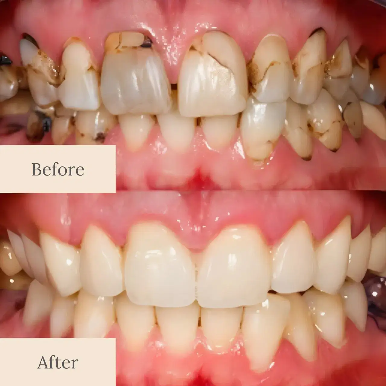 Teeth Armor Drops - Image 8