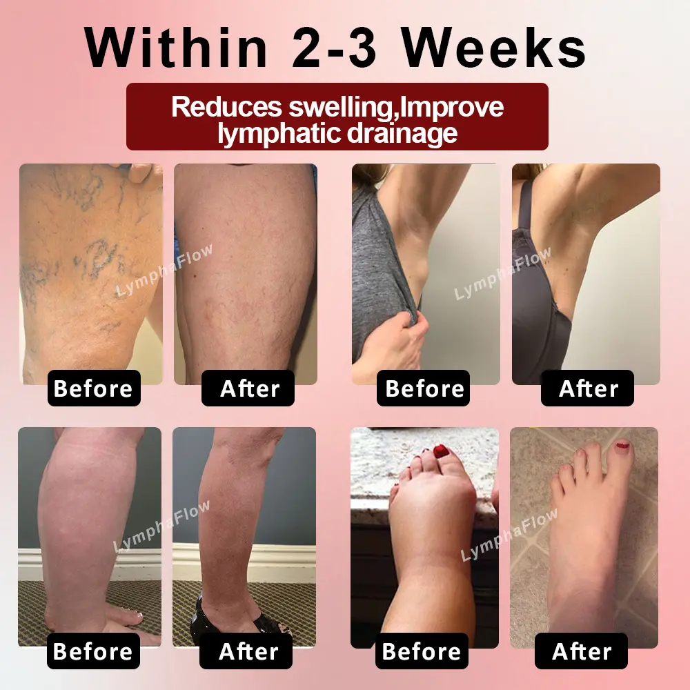 Horse Chestnut SwellAway Massage Gel - Image 2