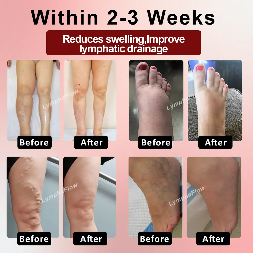 Horse Chestnut SwellAway Massage Gel - Image 3