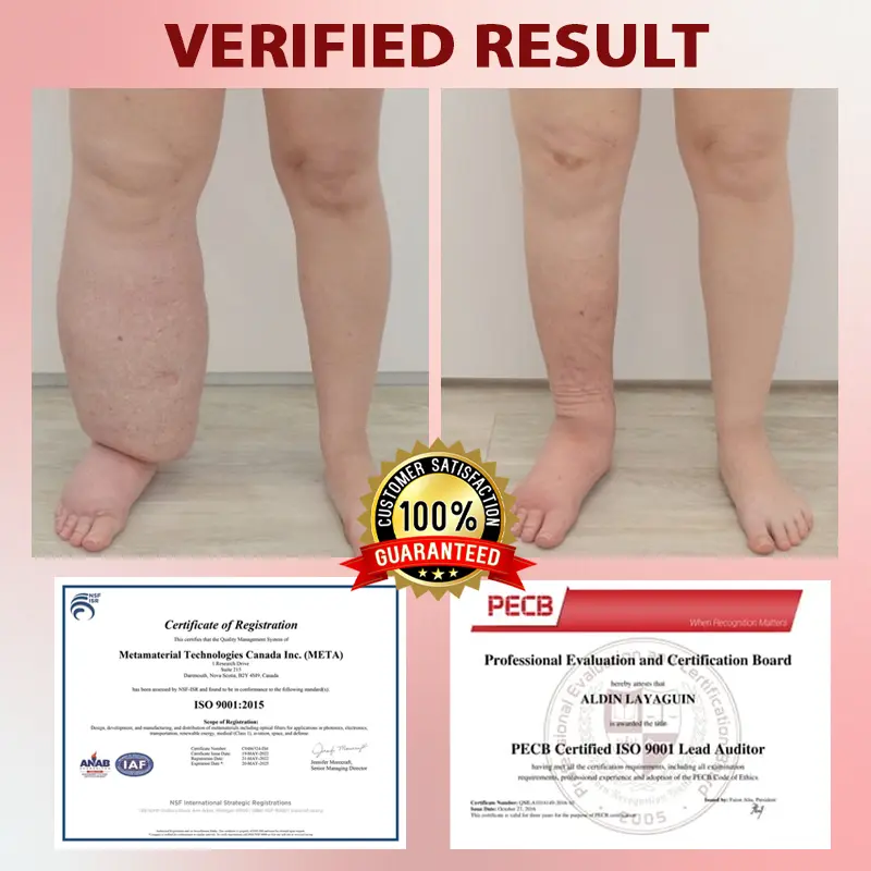 Horse Chestnut SwellAway Massage Gel - Image 4