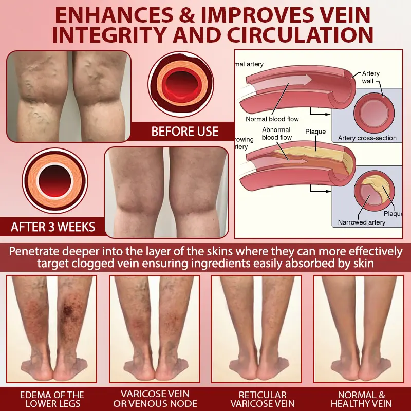 Horse Chestnut SwellAway Massage Gel - Image 9