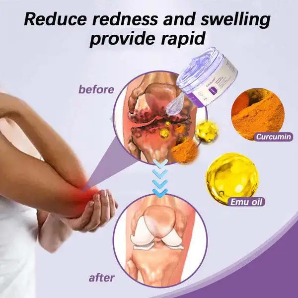 Turmeric & Emu Oil Arthritis Soothing Massage Gel - Image 6