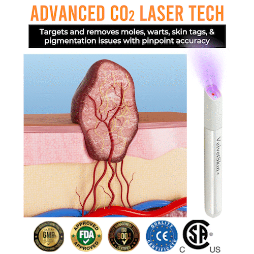 All-in-One CO₂ Laser Eraser Pen - Image 9