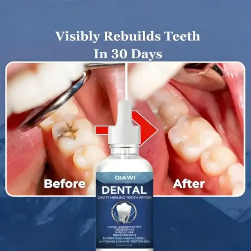 Teeth Armor Drops - Image 5