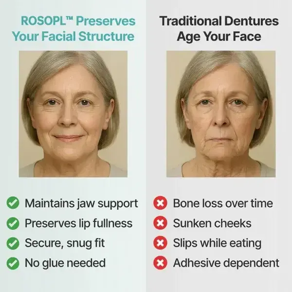 Custom-Fit Functional Dentures - Image 4