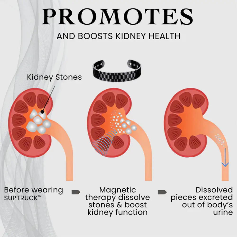 KidneyPower Magnetic Copper Bracelet - Image 4