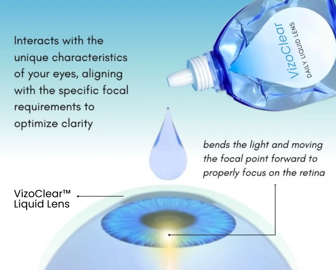Daily Liquid Lens - Image 5