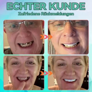 Alternative view of Silikon Reline Gebiss-Set