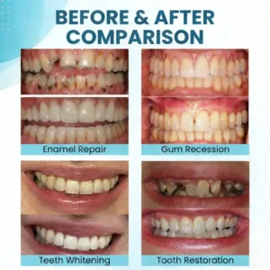 Alternative view of Smilewell Bee Venom Oral Care Powder