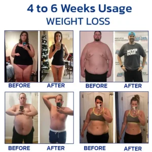 Alternative view of Slenderfast Lymphatic Graphene Bracelet