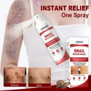 Alternative view of Snail Repair Spray for Itchy, Flaky Psoriasis Skin