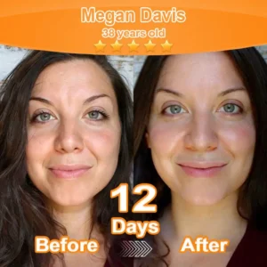 Alternative view of Stem Cell Extract EGF and Copper Peptide Revitalizing Essence Cream