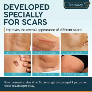 Alternative view of ScarAway Advanced Scar Gel