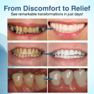 Alternative view of The Non-Surgical Way to Save Your Teeth: Dental Pulp Repair & Regeneration.