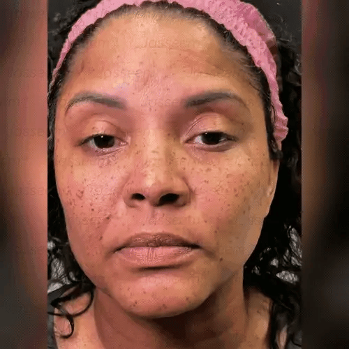 non-invasive laser pen delivers hospital-grade results at home - Image 12