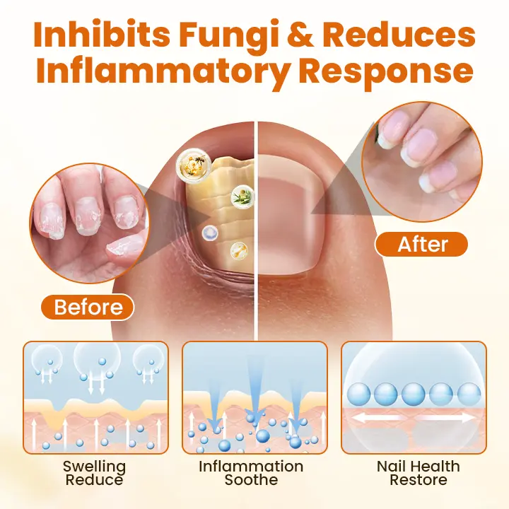 FungiBee Advanced Nail Repair Spray - Image 3