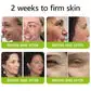 BOTOX & VITA A RETINOL SHOT Wrinkle Lift Tightening Cream - Image 34