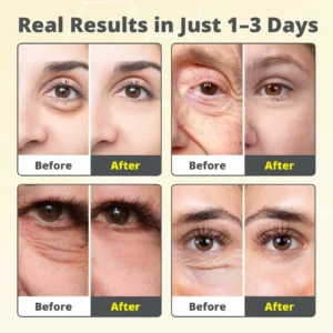 Alternative view of The 7-Day V-Line Shot: Vita A Retinal Tightening Serum