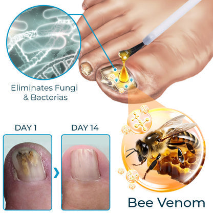 Bee Venom Nail Fungus Treatment Elixir - Image 4