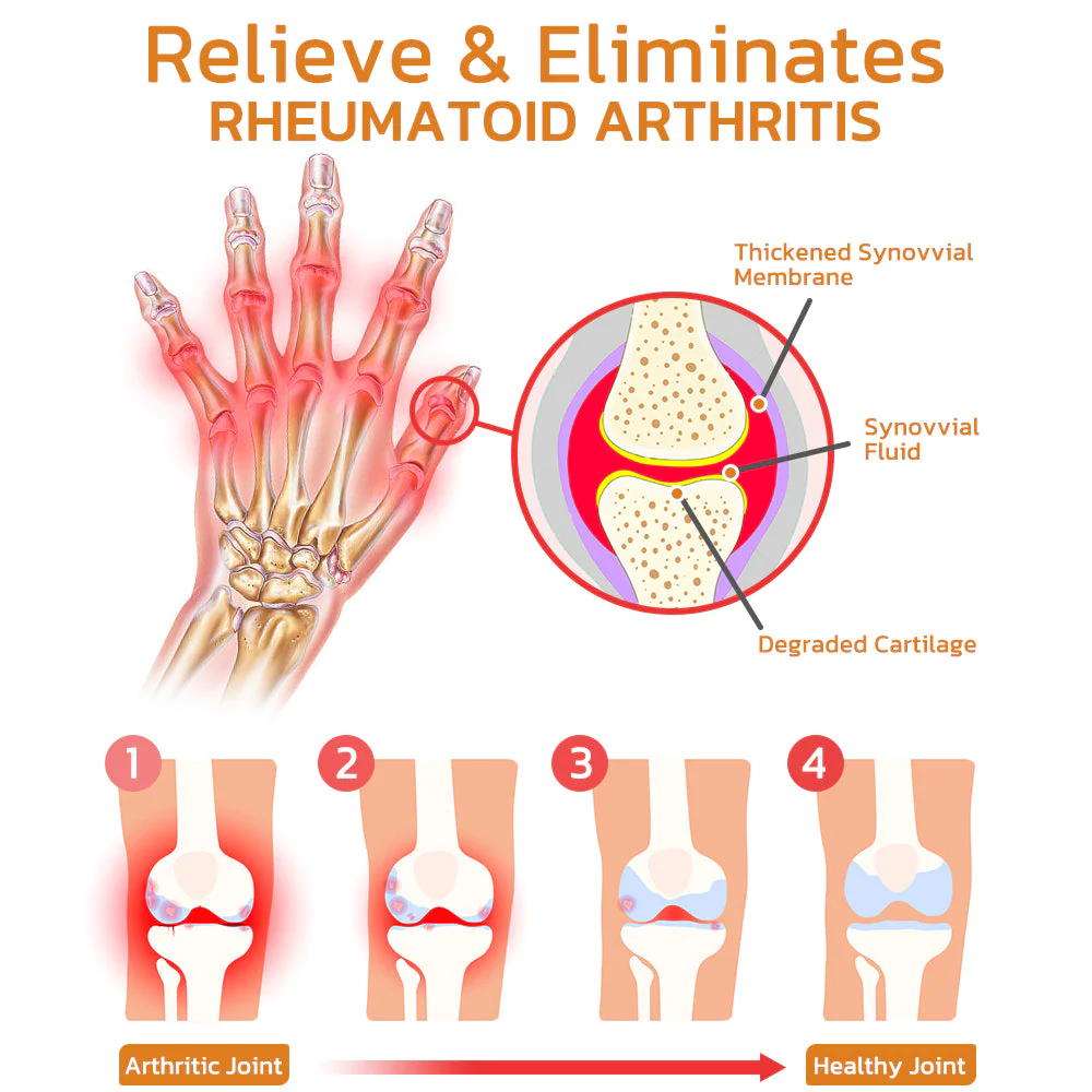 Bee Venom Joint and Bone Therapy Spray - Image 4