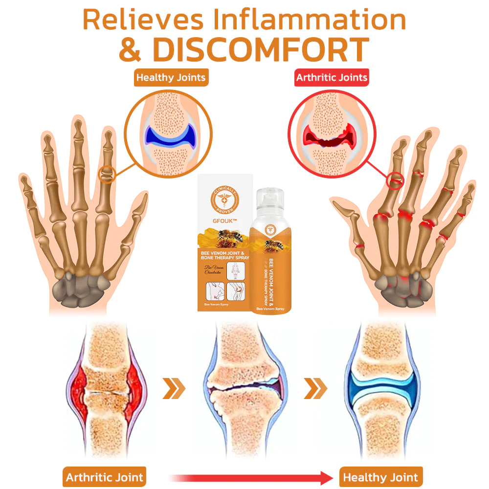 Bee Venom Joint and Bone Therapy Spray - Image 5
