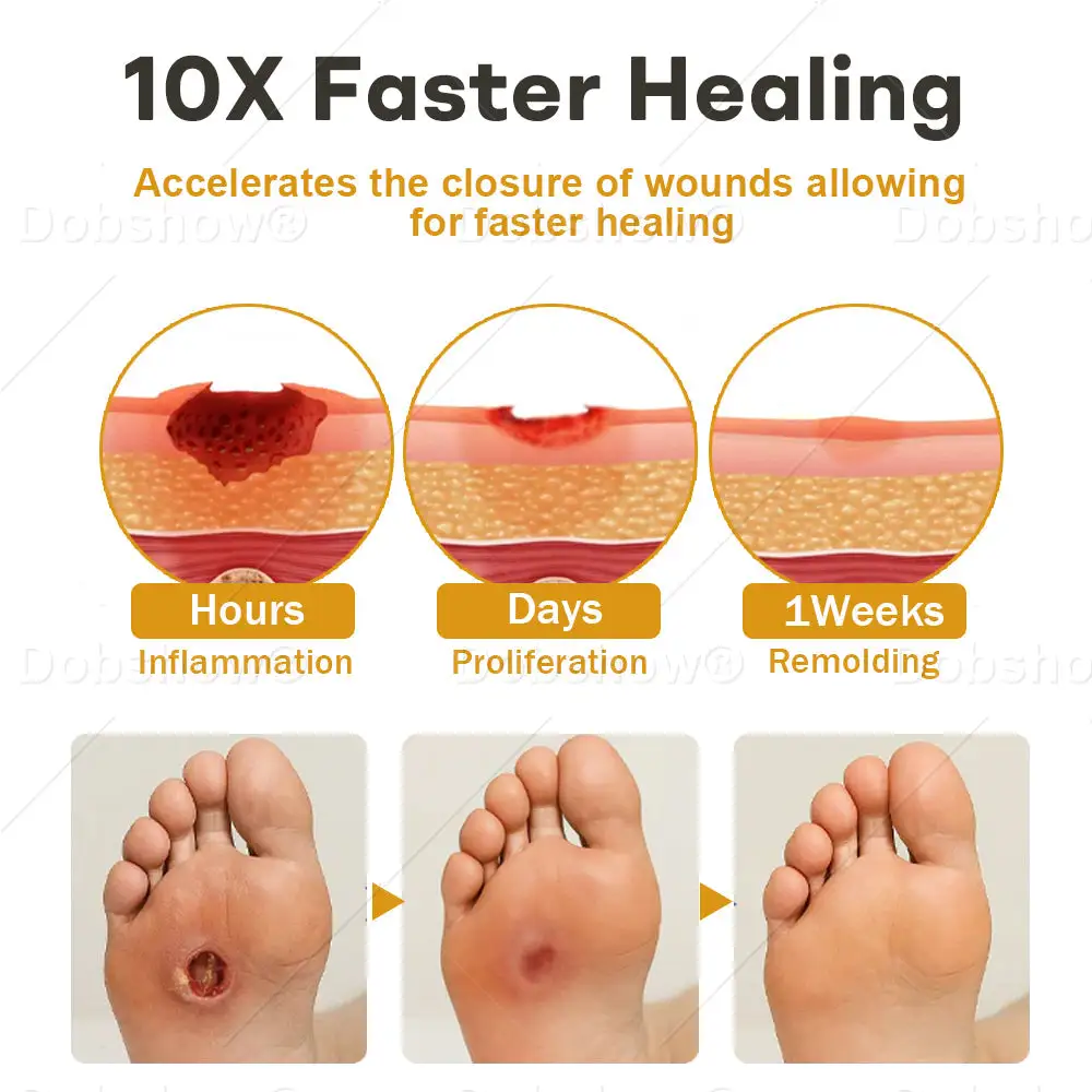 ⭐ 𝘽𝙚𝙨𝙩 𝙎𝙚𝙡𝙡𝙚𝙧 | GlucoShield Bee Venom Wound Spray - Image 6