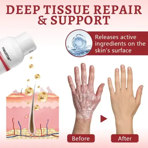 Snail Mucin Healing Spray - Image 3