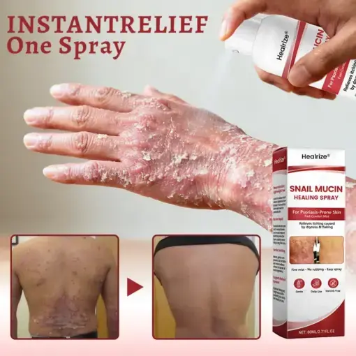 Snail Mucin Healing Spray - Image 7