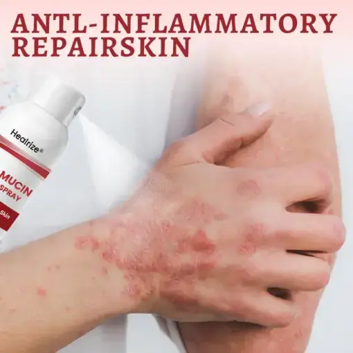 Snail Mucin Healing Spray - Image 9