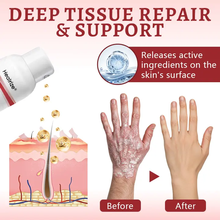 Snail Mucin Healing Spray – Relief for Sensitive & Flare-Up Skin - Image 3