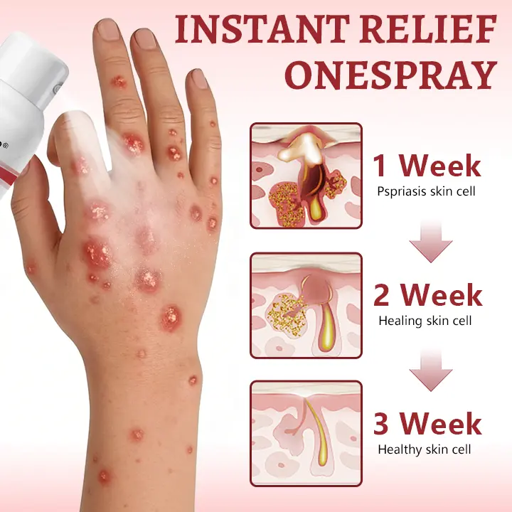 Snail Mucin Healing Spray – Relief for Sensitive & Flare-Up Skin - Image 5