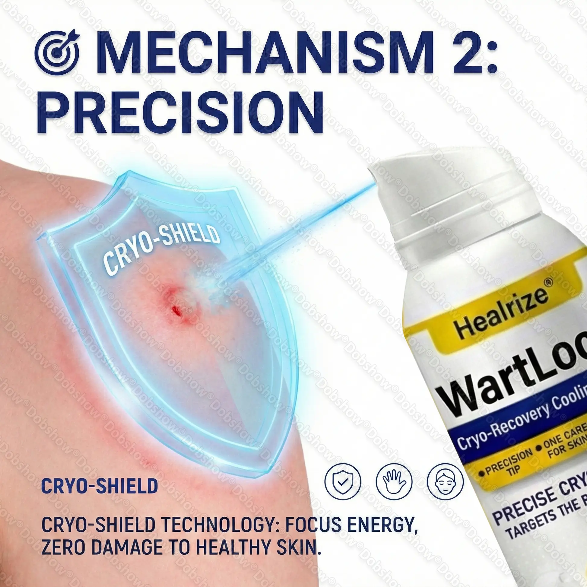 ๐ฅ๐๐๐ง๐๐ ๐๐ฅ๐๐๐๐๐ก ๐๐๐๐๐ง๐จ | WartLock Cryo-Recovery Cooling Spray - Image 3